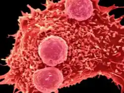 kitajskie-specialisty-vpervye-oprobovali-metod-gennogo-redaktirovaniya-na-cheloveke