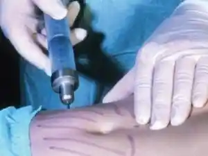 zhenshhiny-predpochitayut-xudet-pod-nozhom-xirurga