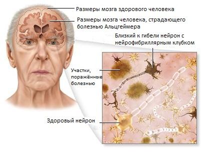 болезнь болезнь