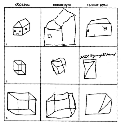 мозг мозг