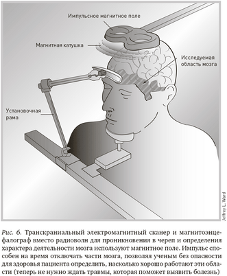 мозг мозг