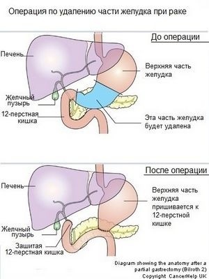 инфекция