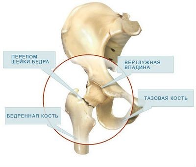 вмешательство вмешательство