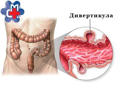 грипп грипп