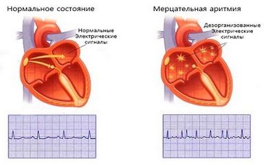 лечение лечение