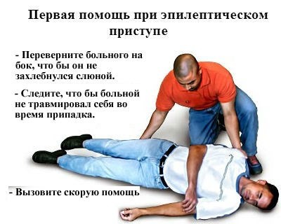 эпилепсия эпилепсия