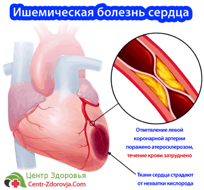 уровень уровень