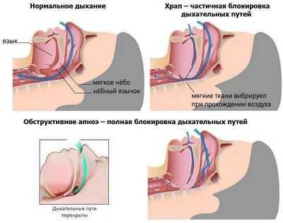 Помогая пациентам дышать во время опасной процедуры, вы предотвращаете осложнения